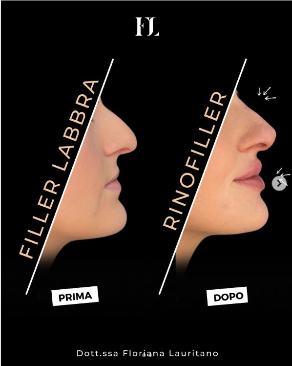 Floriana Lauritano-1