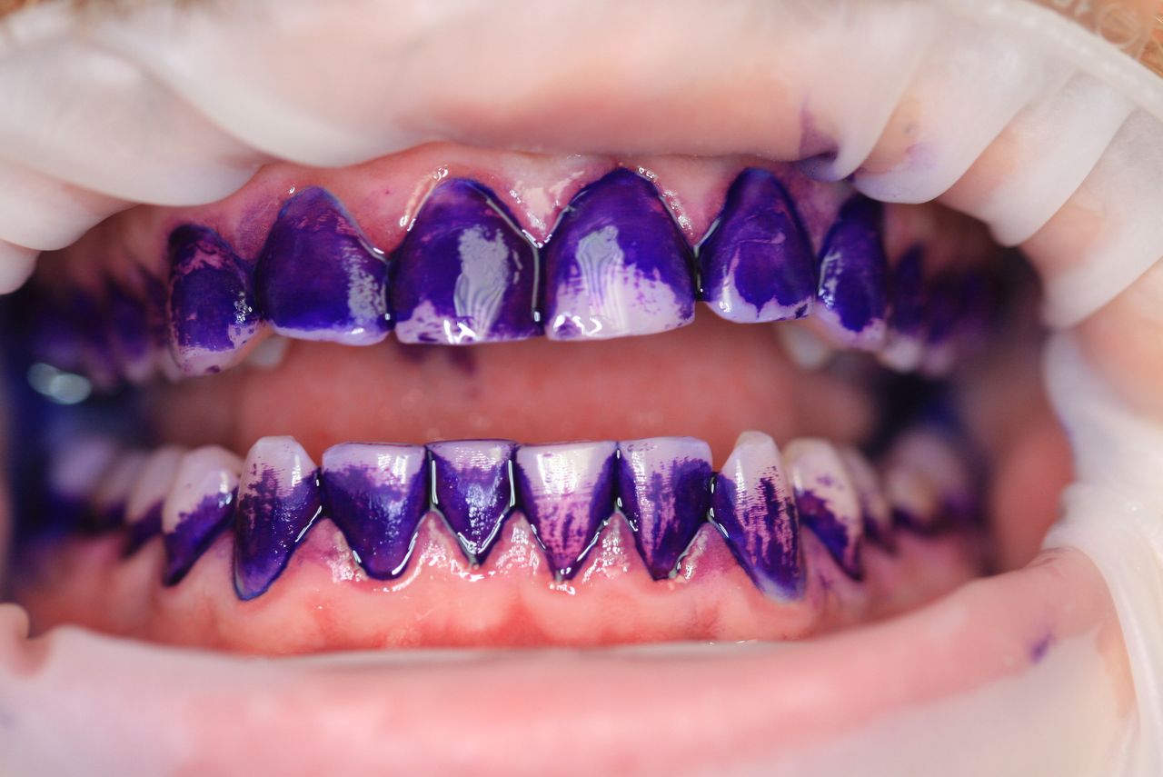 Paulina Sawicka-Soszyńska-23