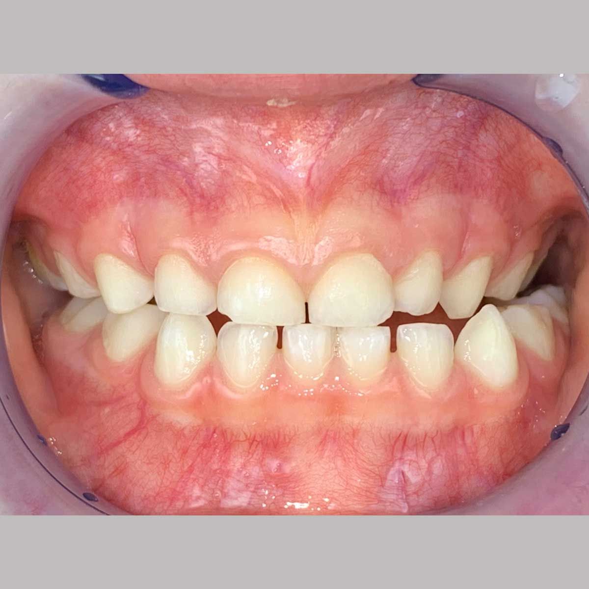 Gianluigi Bittante-45