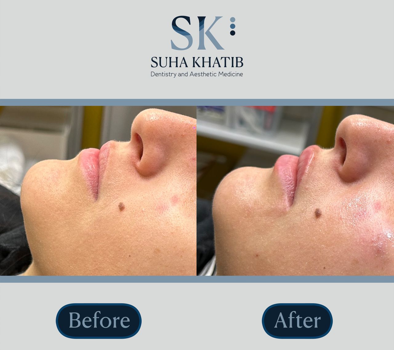 Suha Khatib-16