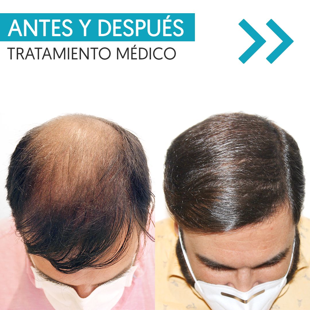 Karlexis León Montilla-5