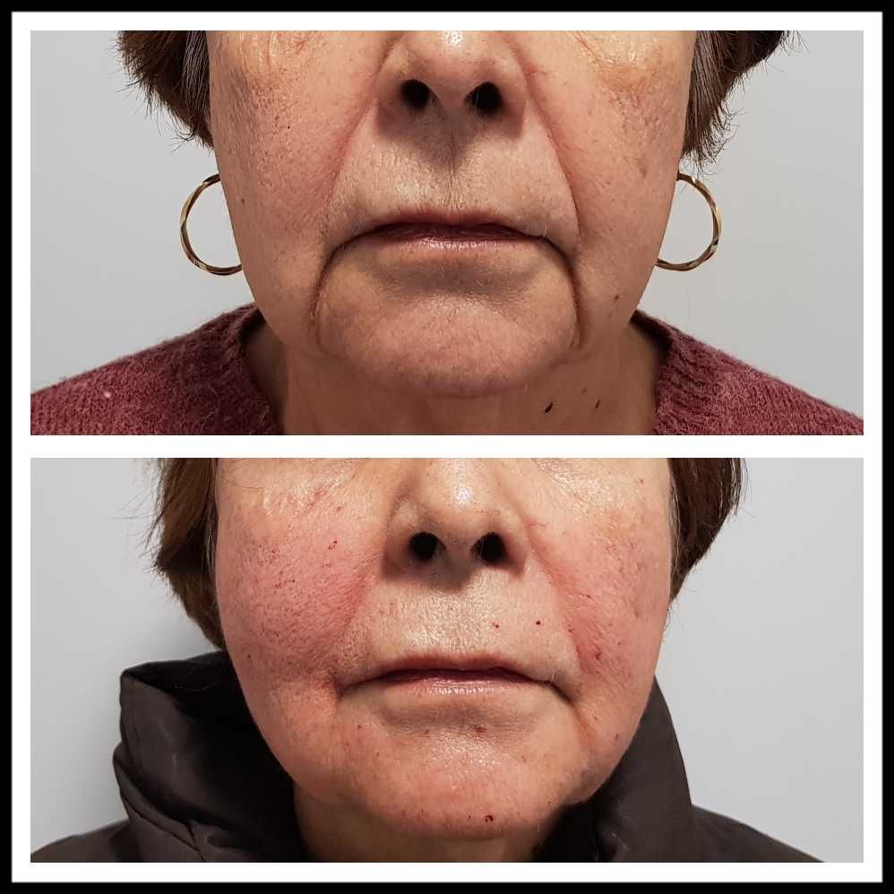 Rosalba Herrero Zerpa-413