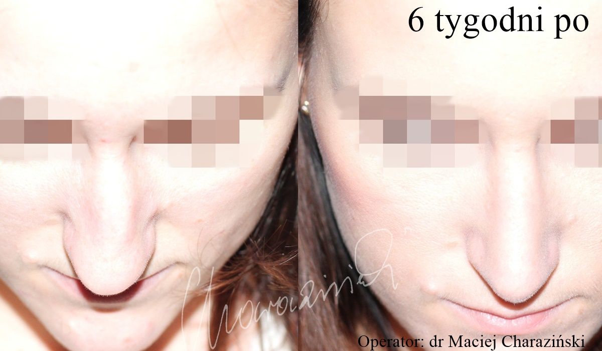 Maciej Charaziński-37