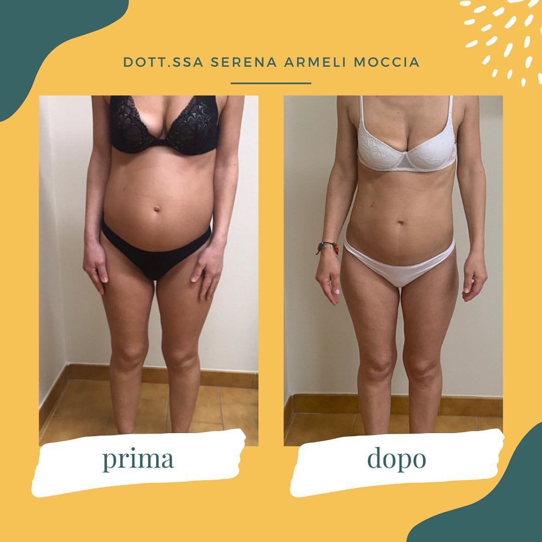 Serena Armeli Moccia-9