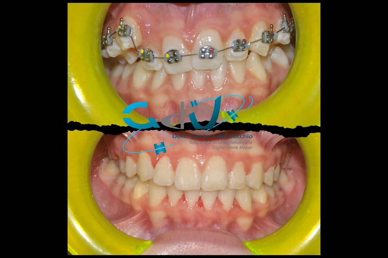 Gianluca Del Vecchio-151