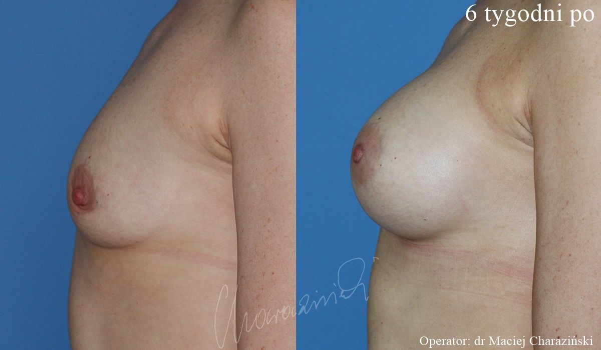 Maciej Charaziński-119