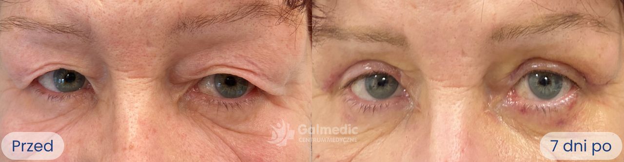 Jakub Staniszewski-7