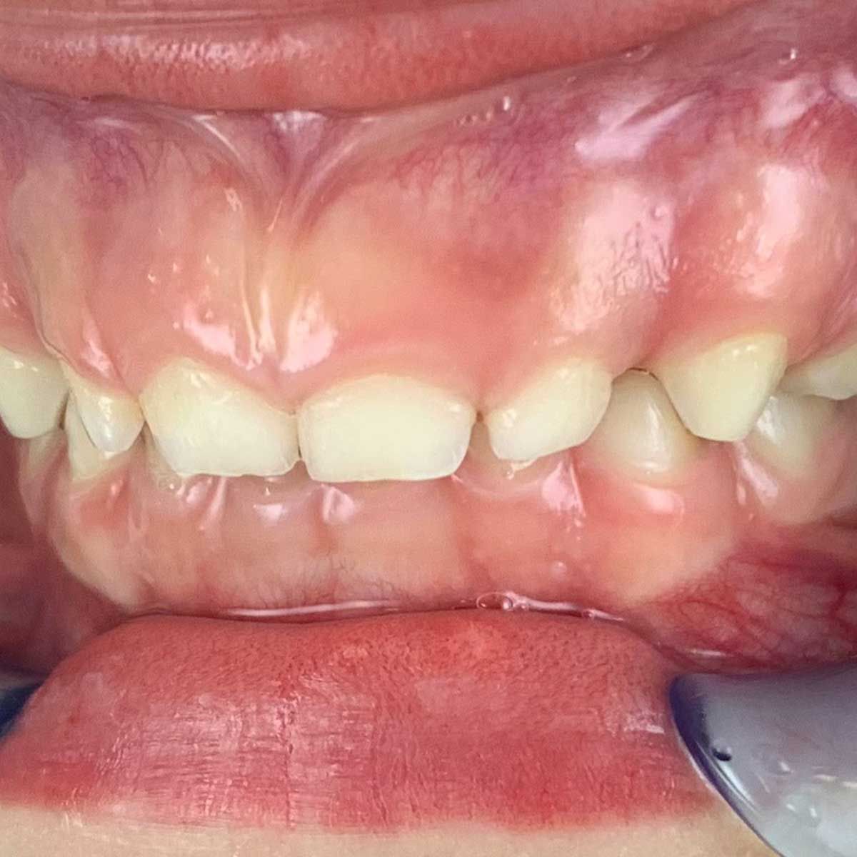 Gianluigi Bittante-42