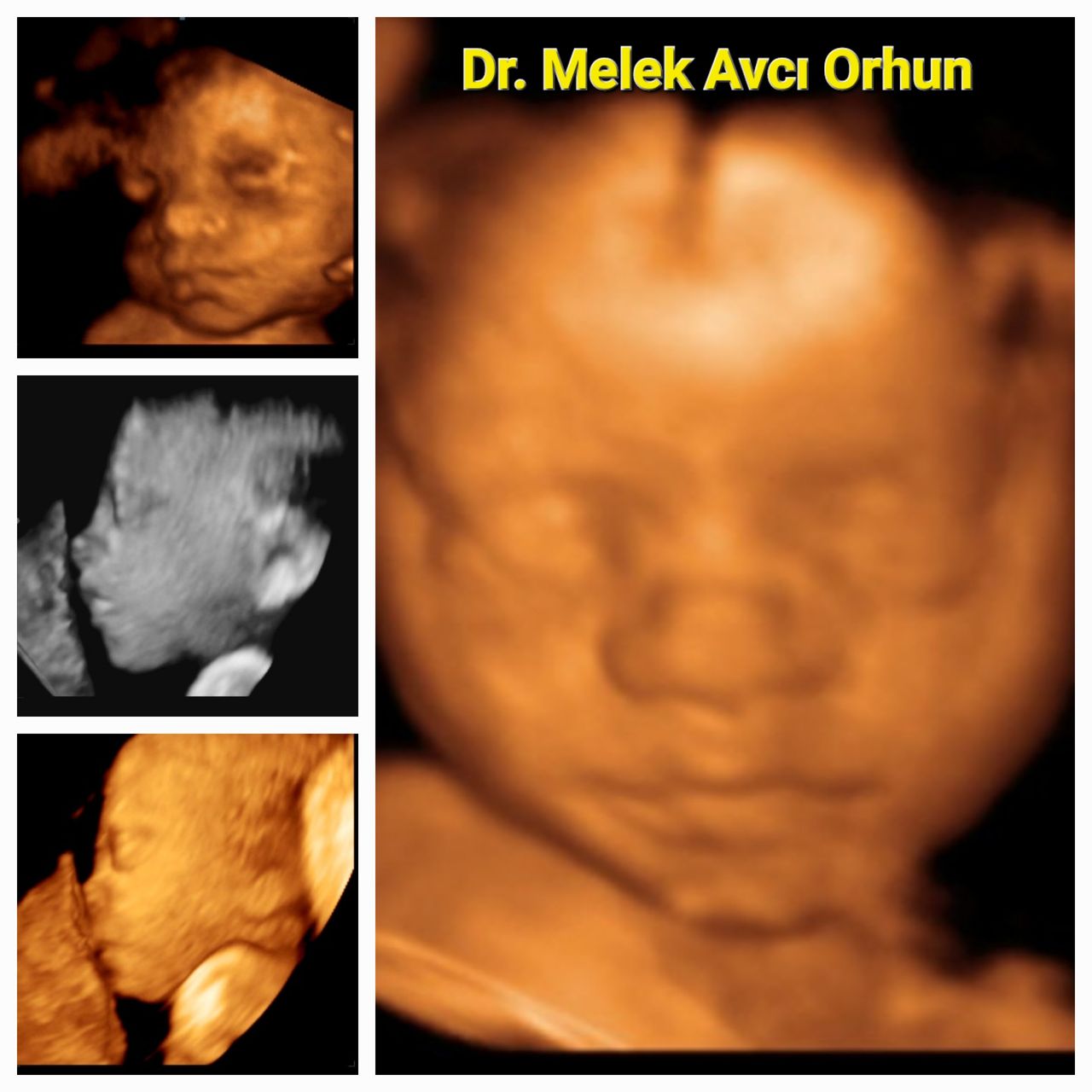 Şahver Melek Avcı Orhun-6