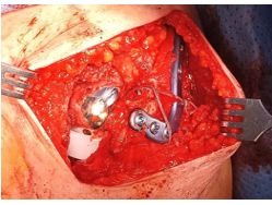 Eulogio Benito Martín-24