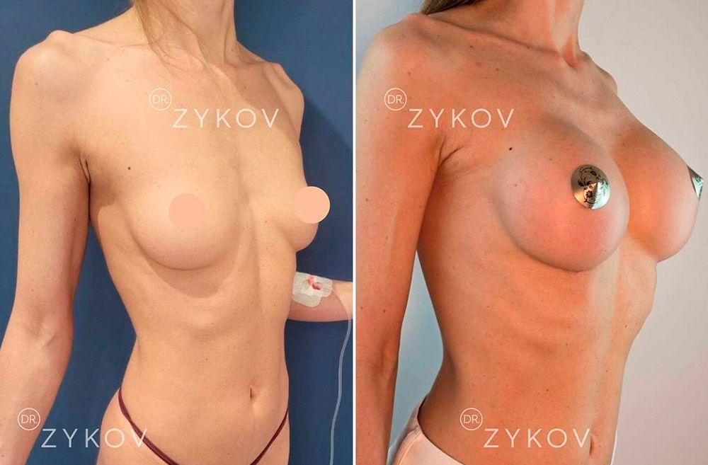 Valentin Zykov-12