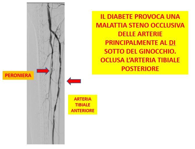 Gianni De Angelis-15