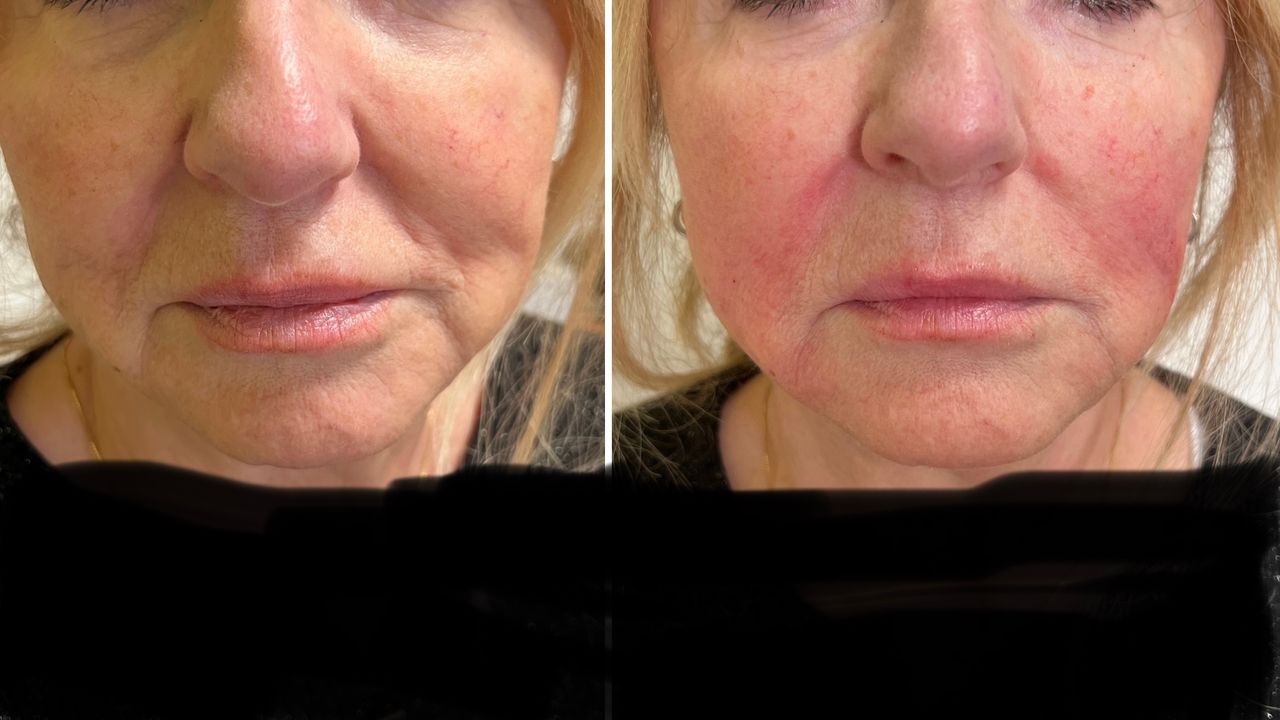 Jacopo Pettinelli-34