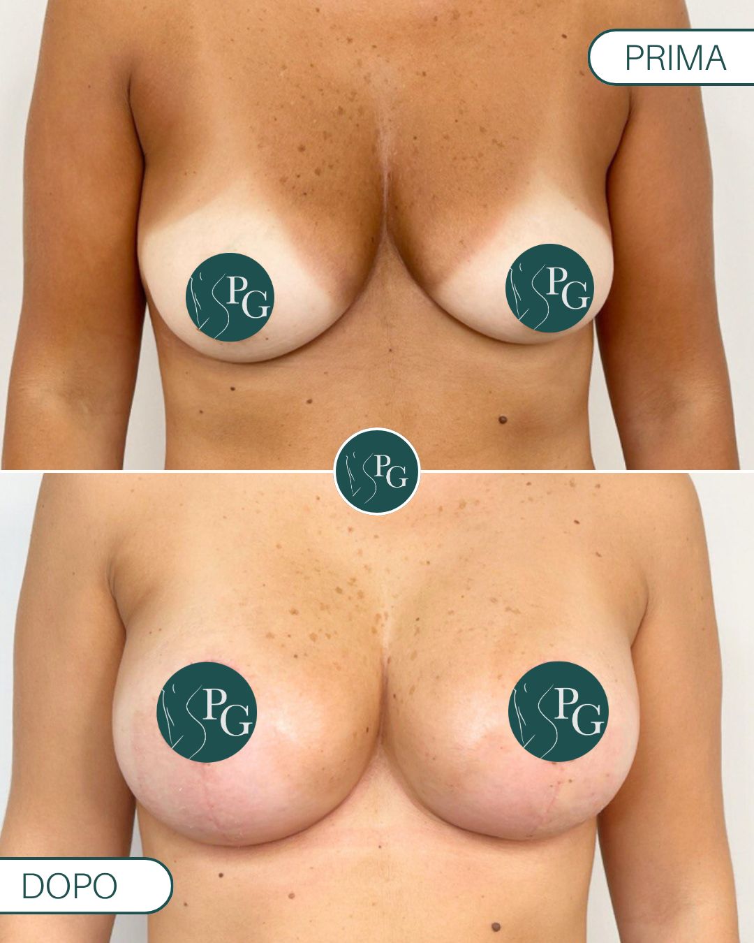 Pasquale Graziano-14