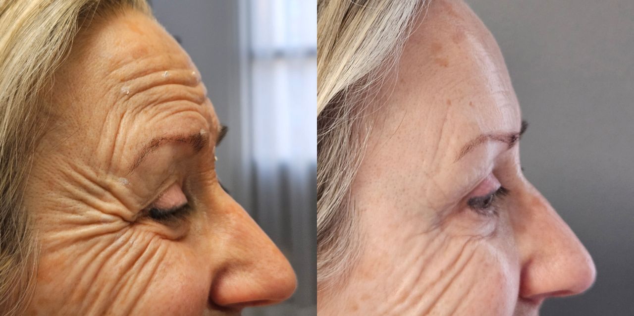 Rosalba Herrero Zerpa-18