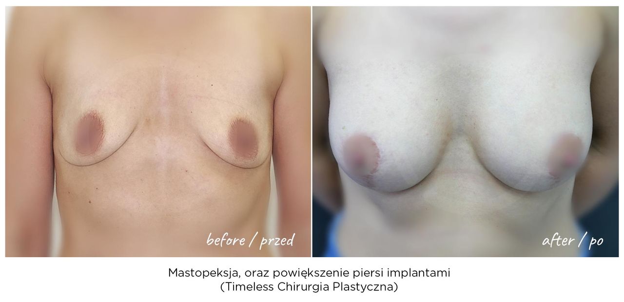 Janusz Jaworowski-45