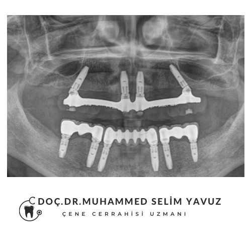 Muhammed Selim Yavuz-9