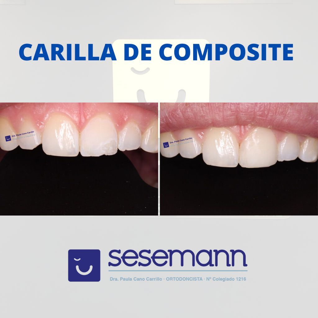 Paula Cano Carrillo-101