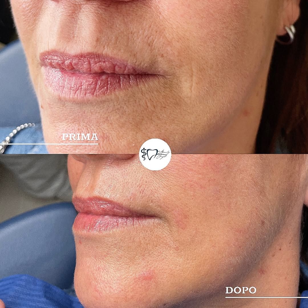 Alessandro Donzelli-14