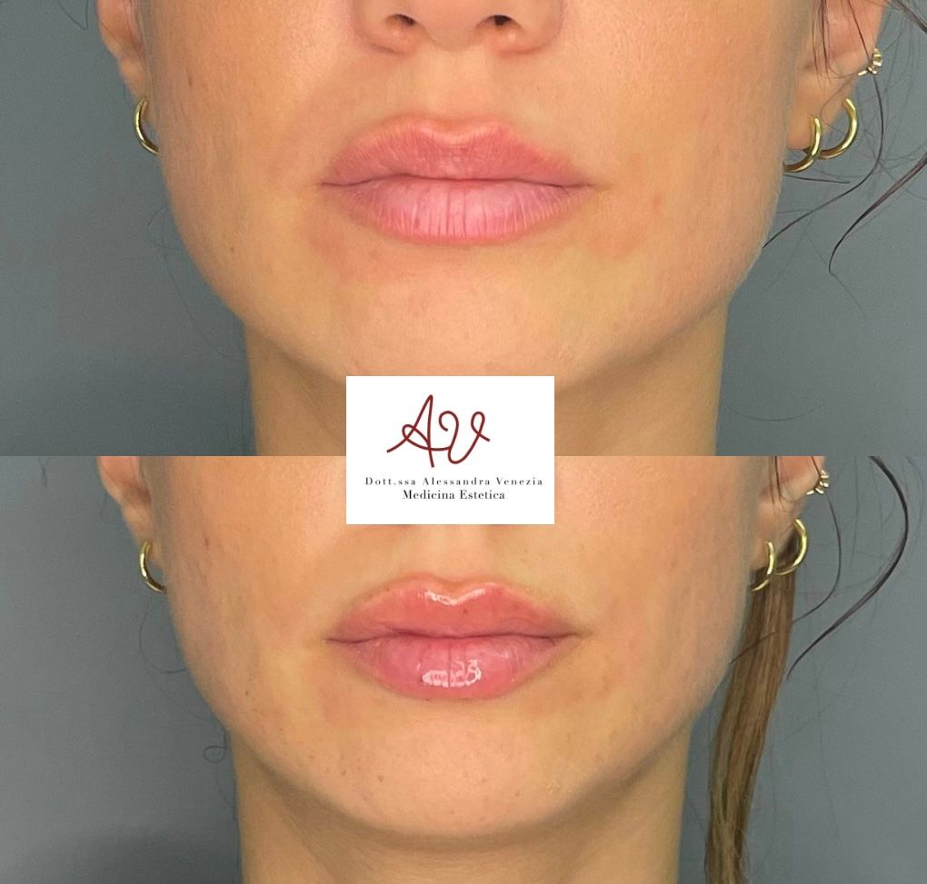 Alessandra Venezia-40