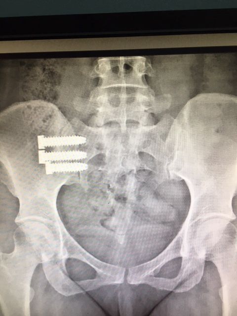 Massimo Brandolin-22