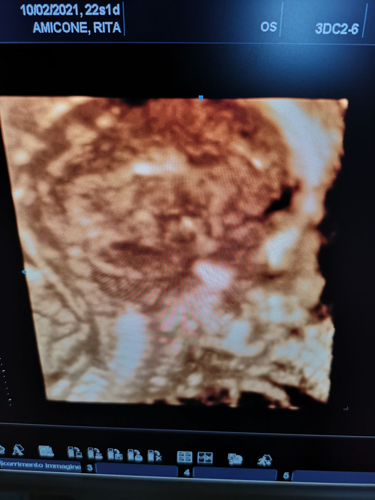 Francesco Paolo Improda-9