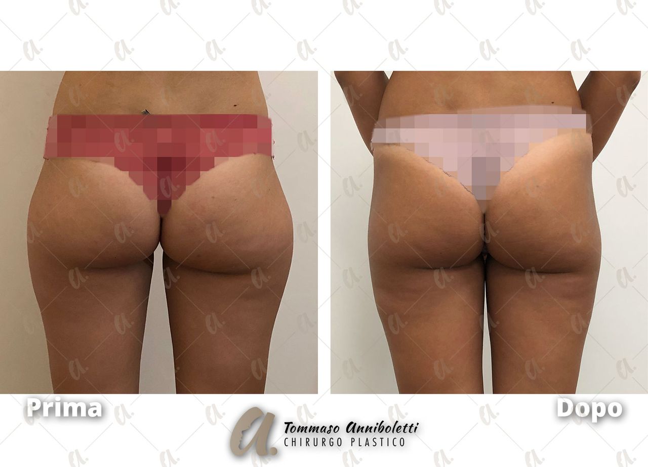 Tommaso Anniboletti-49