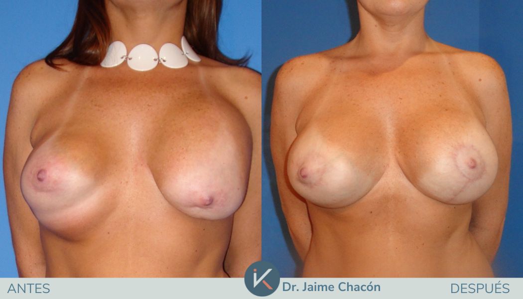 Jaime Eduardo Chacón Hernández-6