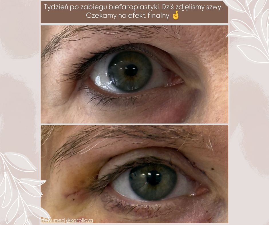 Piotr Florczuk-Dąbek-17