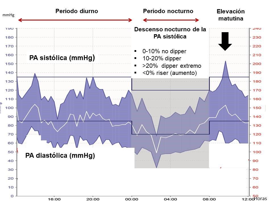 Ainhoa Esteve Arrien-8