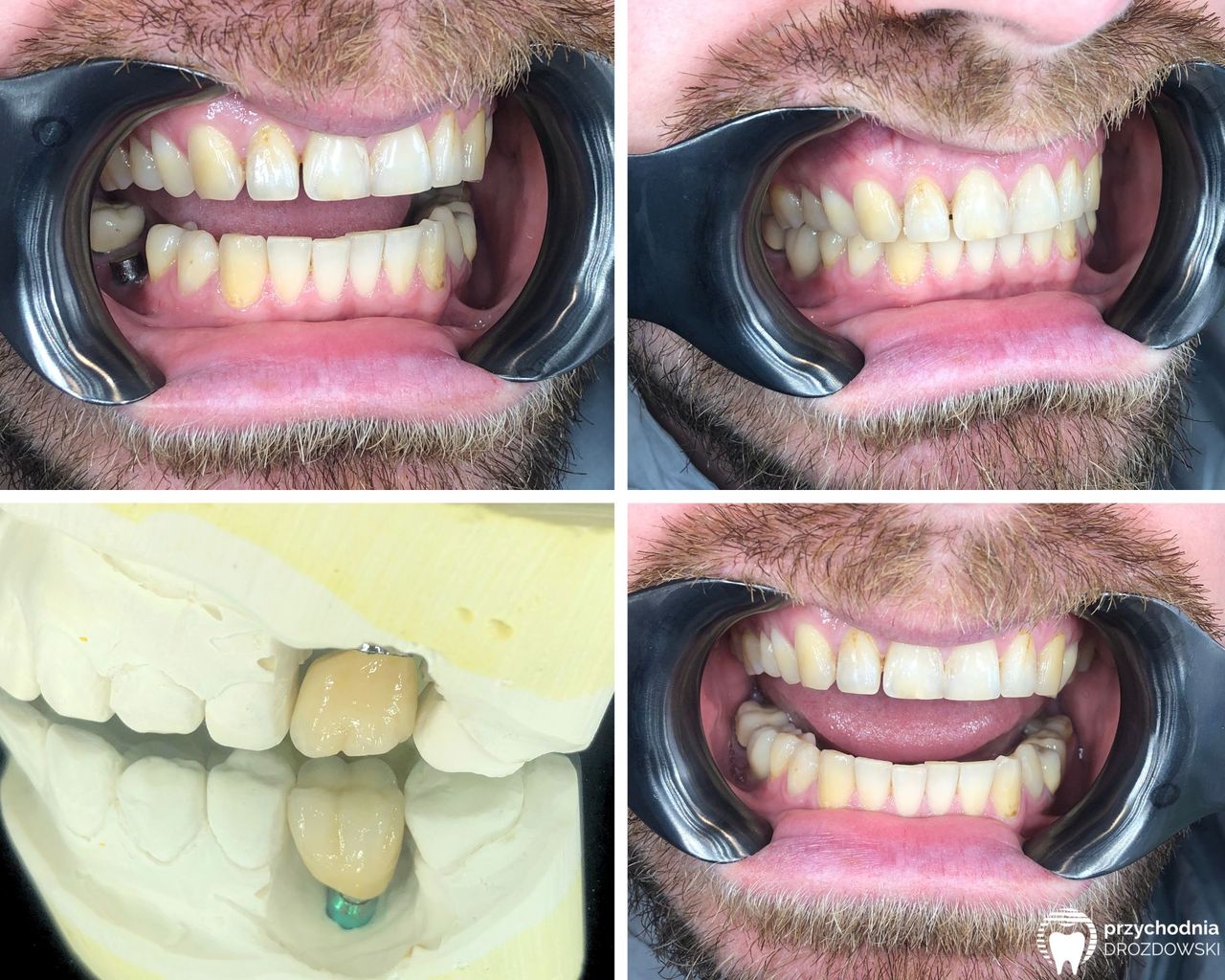 Michał Drozdowski-4