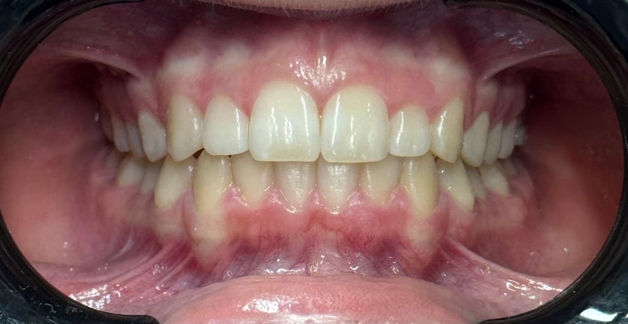 Francesco Sorrentino-6