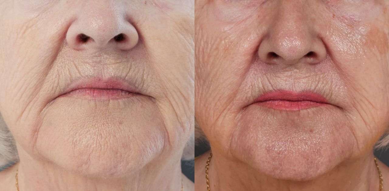 Rosalba Herrero Zerpa-15