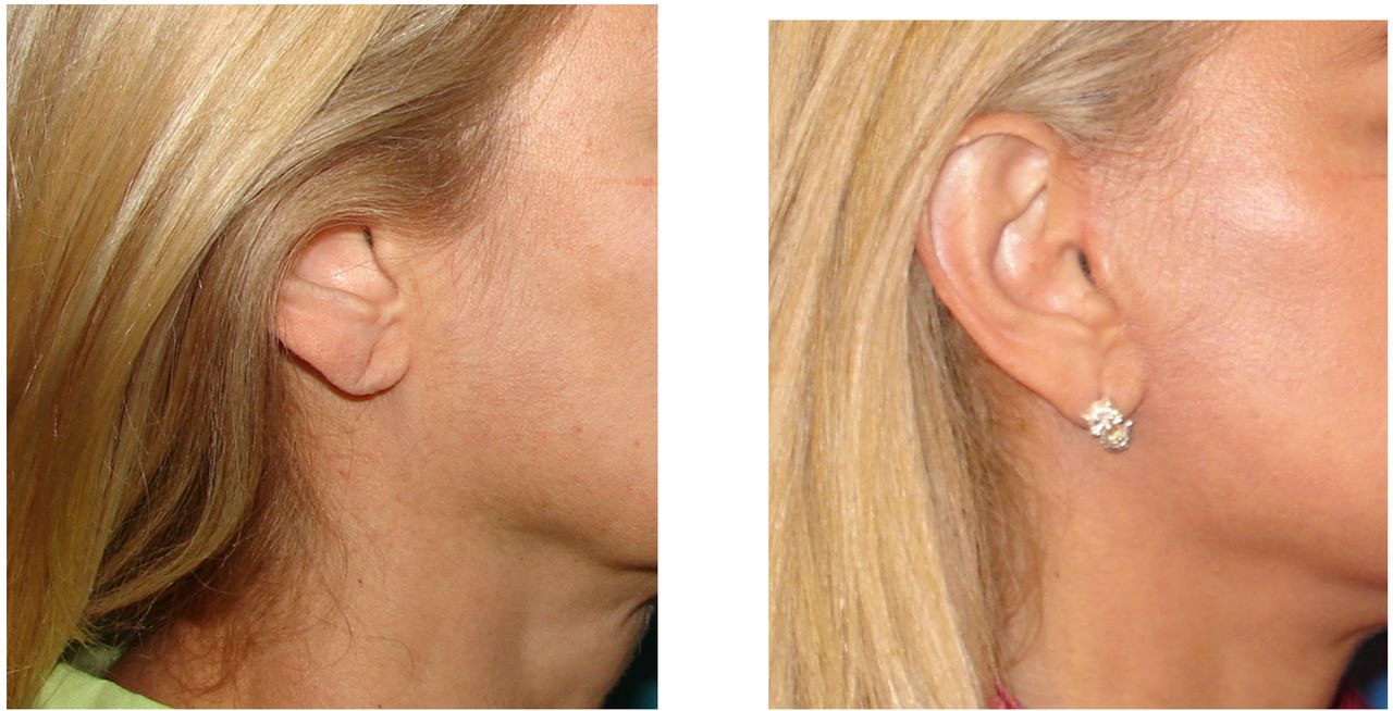 Jaime Eduardo Chacón Hernández-9