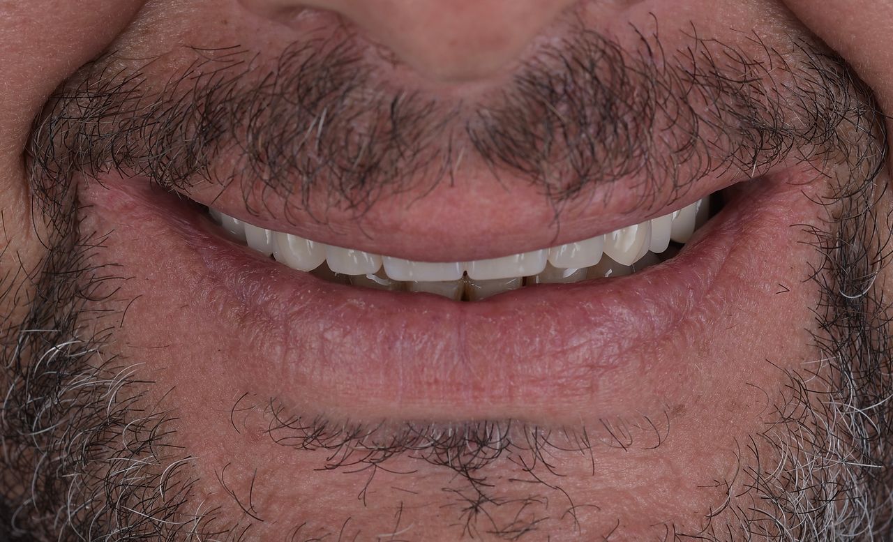 Riccardo Giardina-57