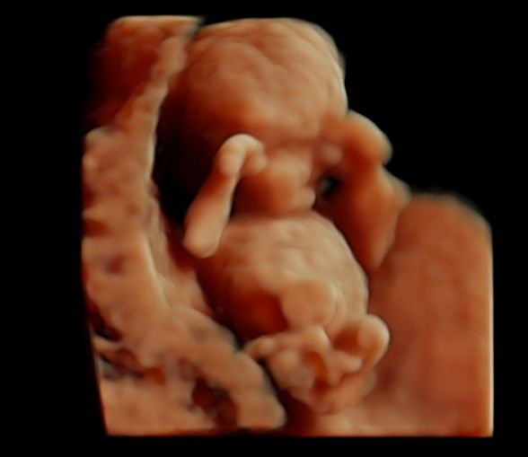 Tommaso Incandela-11