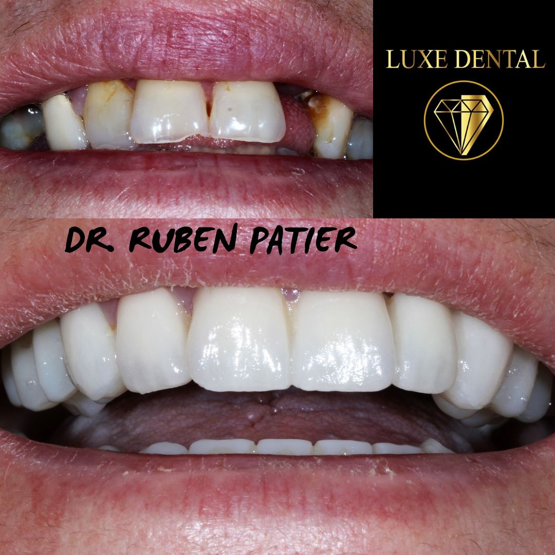 Ruben Patier Martin-22