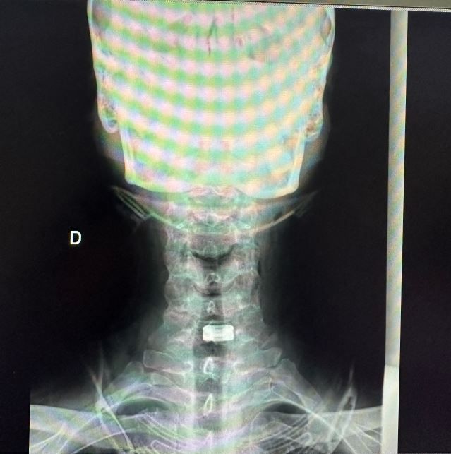 Valerio Cipolloni-20