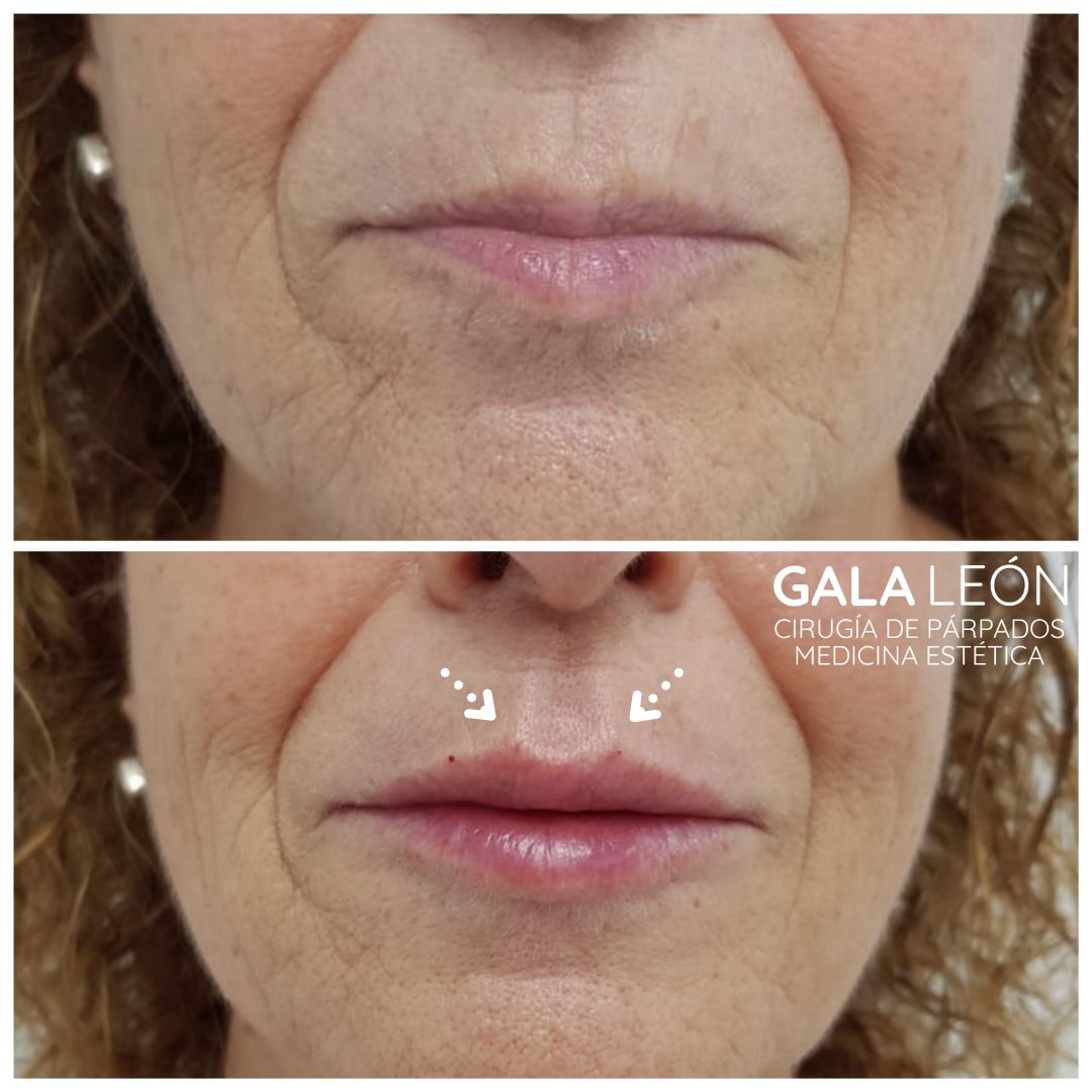 Gala P. Leon Salvatierra-24