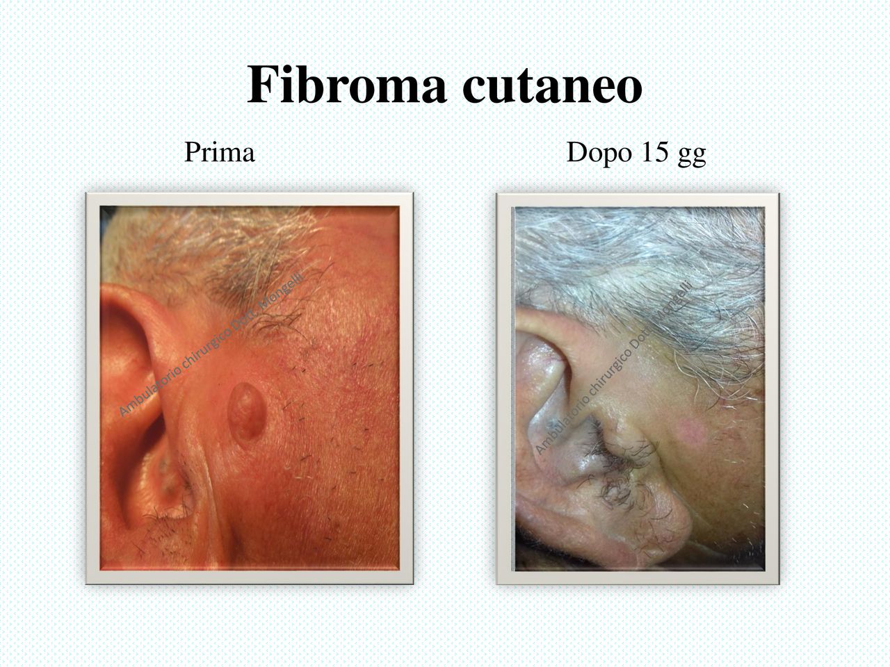 Matteo Antonio Mongelli-10