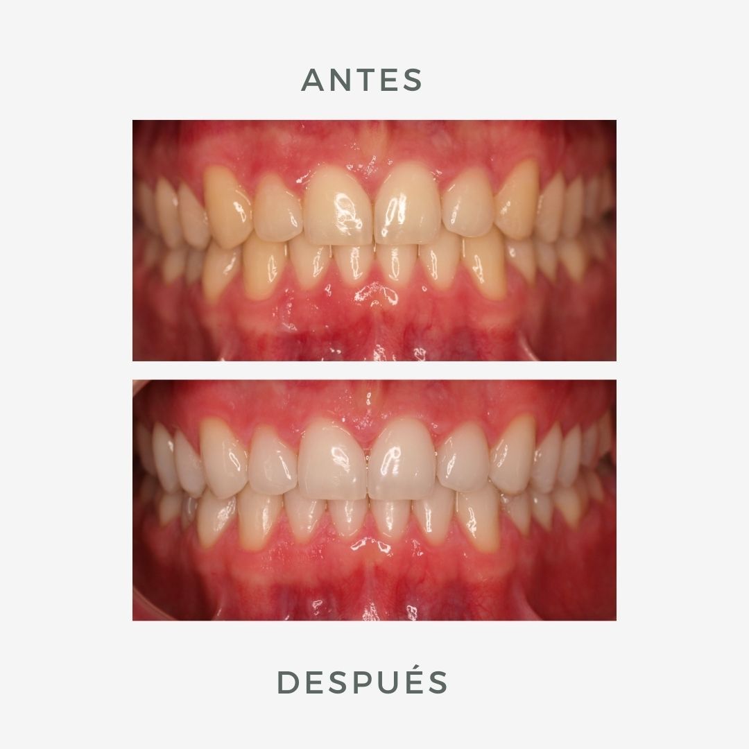 Marien Morata Roig-9