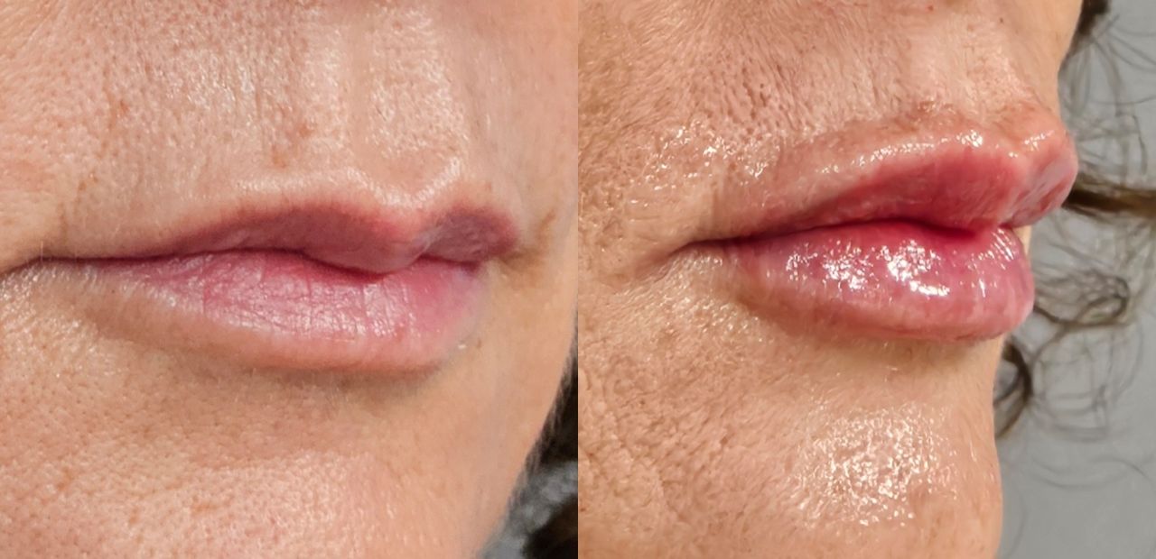 Rosalba Herrero Zerpa-440