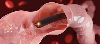 Jose Francisco Juanmartiñena-4