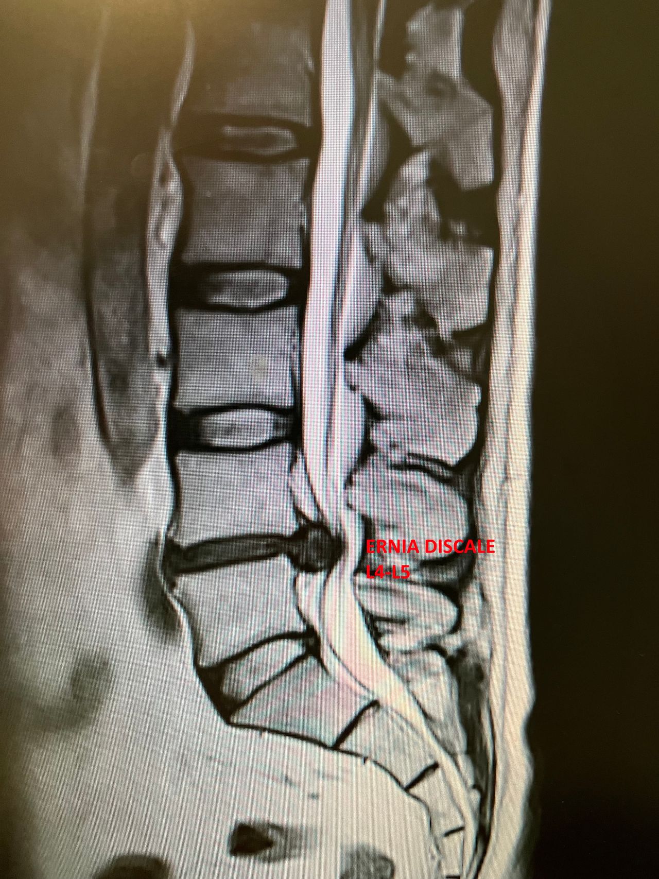 Pietro Brignardello-1