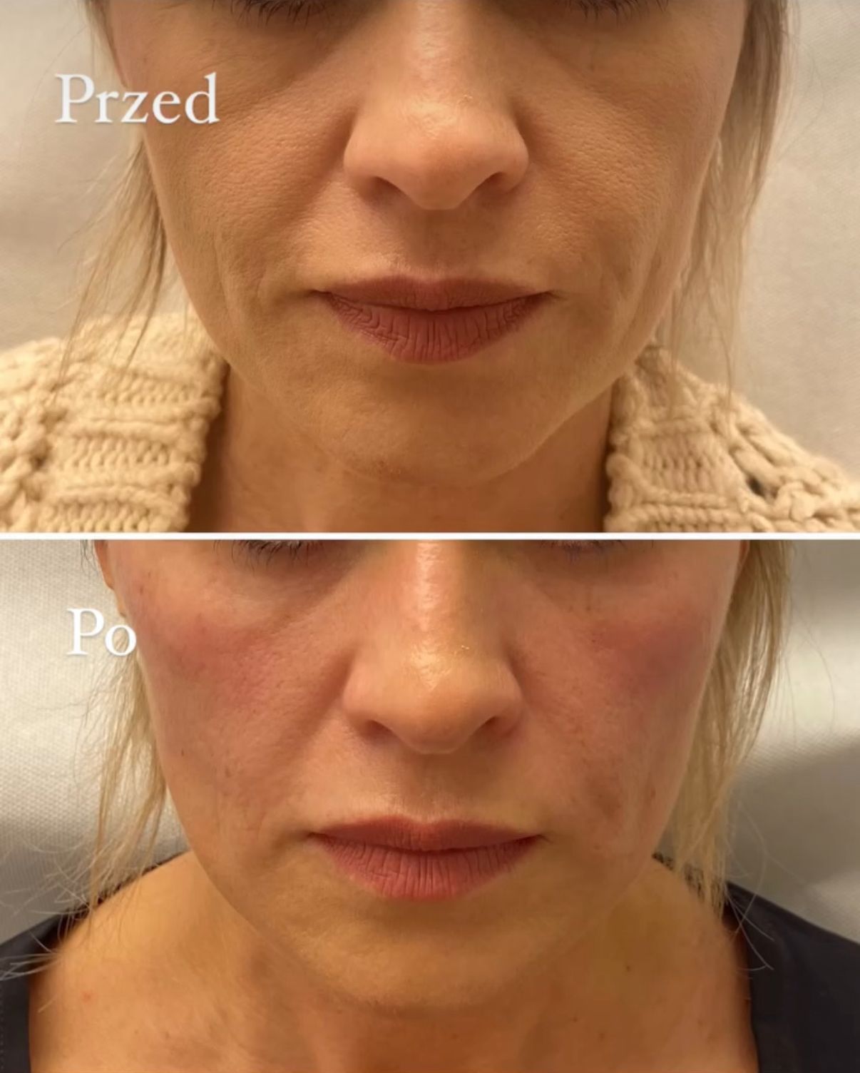 Aleksandra Kowalczuk-17