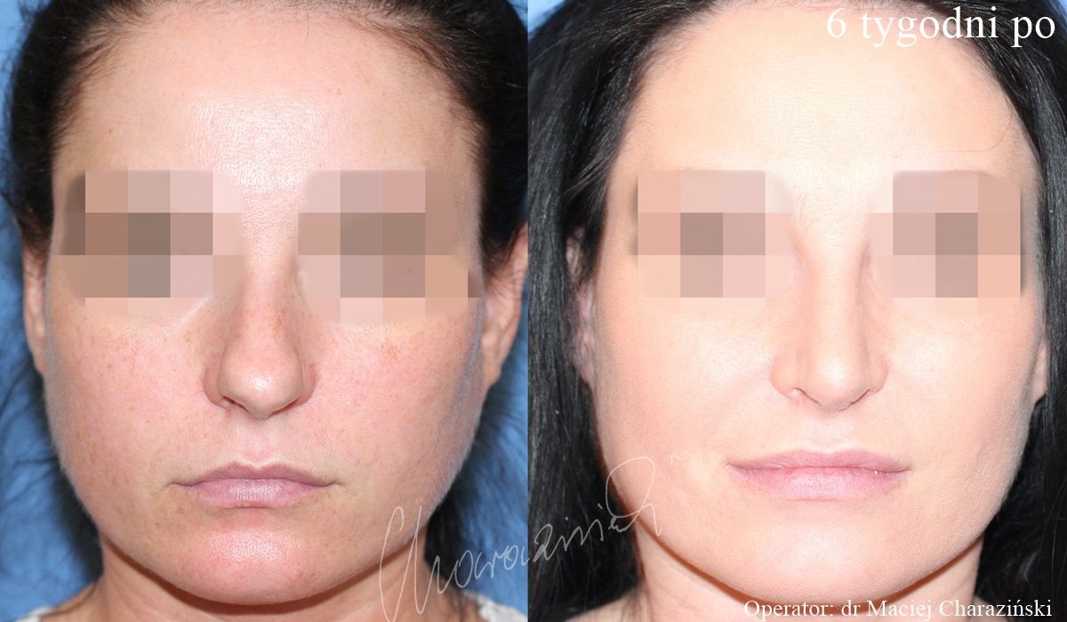 Maciej Charaziński-81