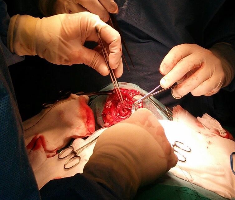 Juan Camilo Hernandez Acevedo-54