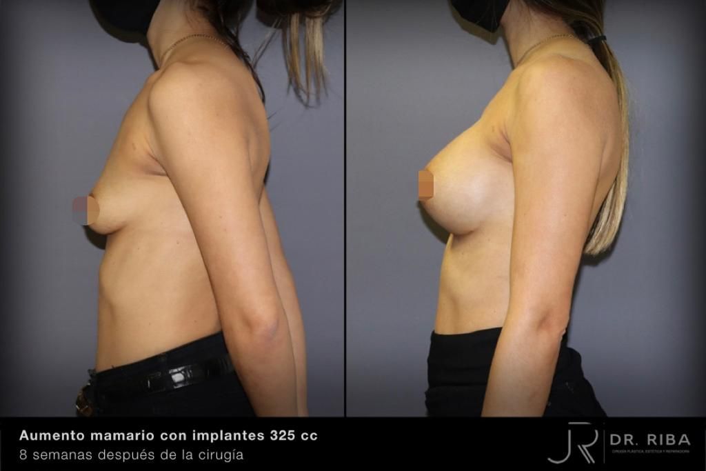 Jordi Riba Vilchez-41