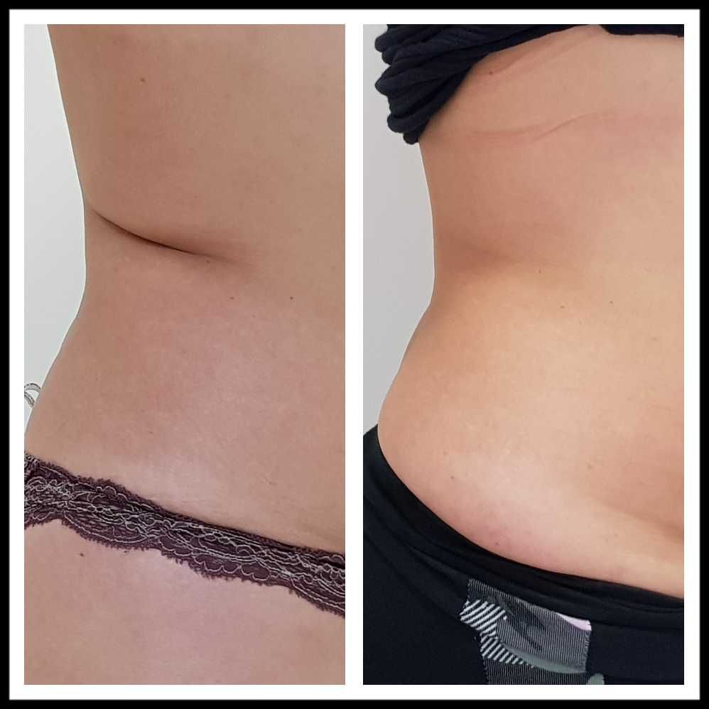 Rosalba Herrero Zerpa-367