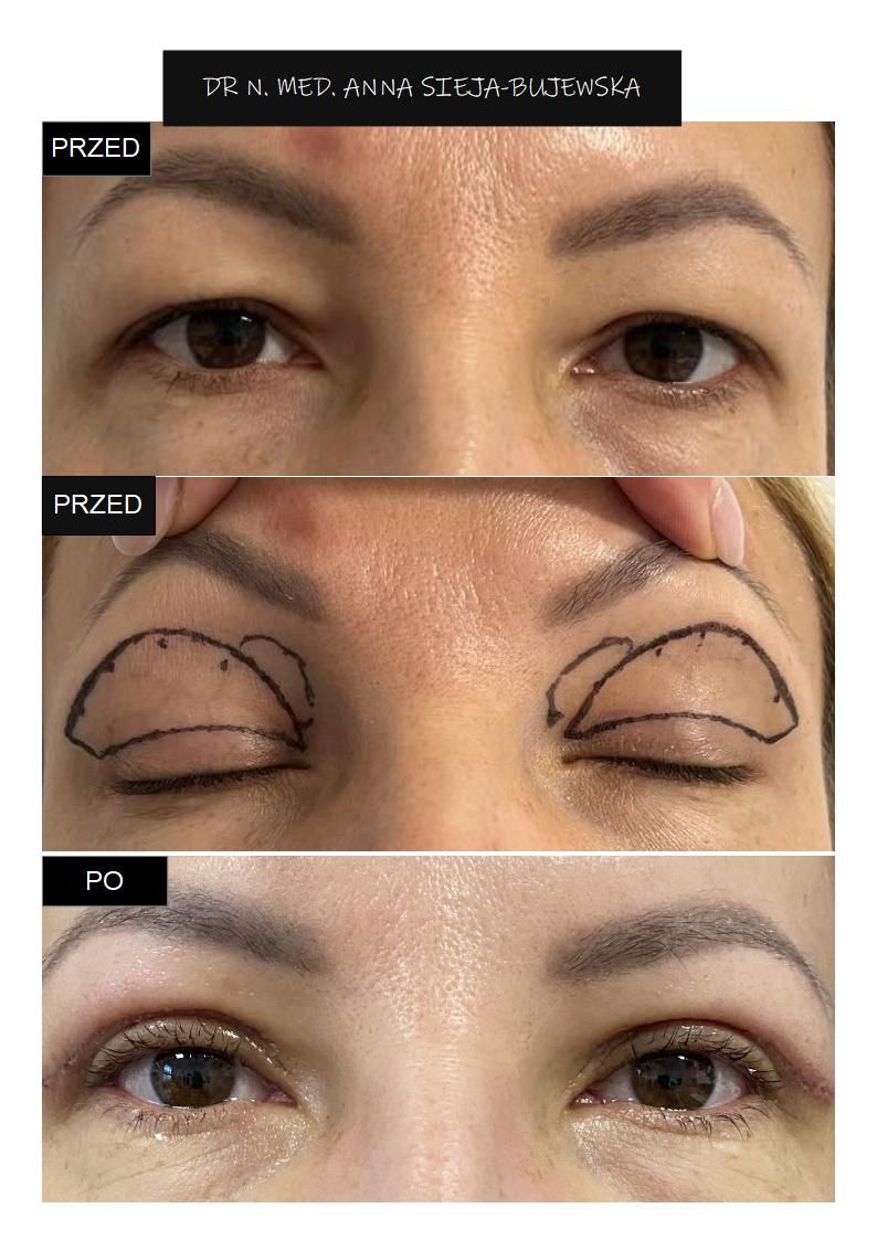 Anna Sieja-Bujewska-1